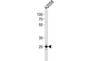 Western Blotting (WB) image for anti-Mitochondrial Ribosomal Protein L28 (MRPL28) antibody (ABIN3000729) (MRPL28 antibody)