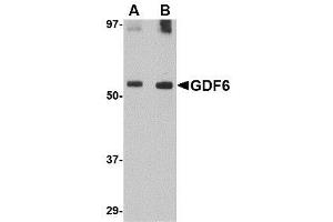 Image no. 1 for anti-Growth Differentiation Factor 6 (GDF6) (C-Term) antibody (ABIN342682) (GDF6 antibody  (C-Term))