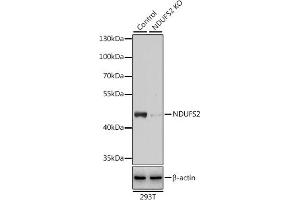 Western blot analysis of extracts from normal (control) and NDUFS2 knockout (KO) 293T cells, using NDUFS2 antibody (ABIN6133022, ABIN6144484, ABIN6144485 and ABIN7101413) at 1:3000 dilution. (NDUFS2 antibody  (AA 204-463))