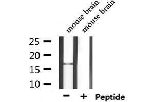 Western blot analysis of extracts from mouse brain, using CALML3 Antibody. (CALML3 antibody  (Internal Region))