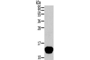 Western Blot analysis of Human normal liver tissue using THRSP Polyclonal Antibody at dilution of 1/400 (THRSP antibody)