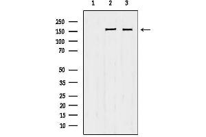 anti-Protein Tyrosine Phosphatase F Interacting Protein 1 (PPFIA1) (C-Term) antibody