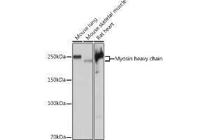 MYH7 antibody