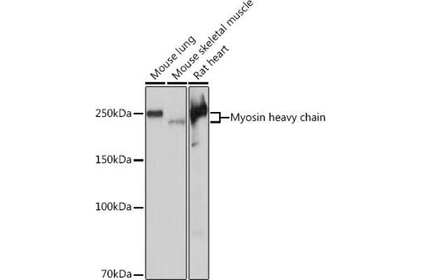 MYH7 antibody