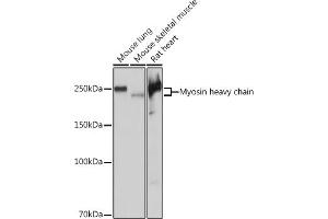 Western blot analysis of extracts of various cell lines, using Myosin heavy chain Rabbit mAb (ABIN7268750) at 1:5000 dilution. (MYH7 antibody)