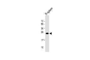 Anti-LIF Antibody (Center) at 1:1000 dilution + Rat spleen lysate Lysates/proteins at 20 μg per lane. (LIF antibody  (AA 72-101))