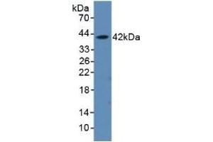 Detection of Recombinant aHSP, Rat using Polyclonal Antibody to Alpha-Hemoglobin Stabilizing Protein (aHSP) (aHSP antibody  (AA 2-102))