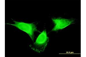 Immunofluorescence of monoclonal antibody to C19orf10 on HeLa cell. (C19orf10 antibody  (AA 1-173))