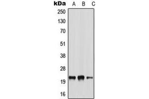 Western blot analysis of NRSN2 expression in A549 (A), NIH3T3 (B), H9C2 (C) whole cell lysates. (NRSN2 antibody  (Center))
