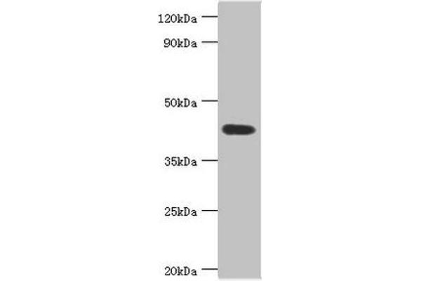 ASAH1 antibody  (AA 146-395)