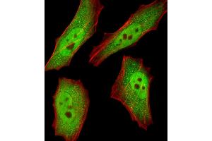 Fluorescent image of HeLa cells stained with RBX1 Antibody . (RBX1 antibody  (C-Term))