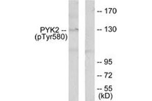 Western blot analysis of extracts from K562 cells, using PYK2 (Phospho-Tyr580) Antibody. (PTK2B antibody  (pTyr580))