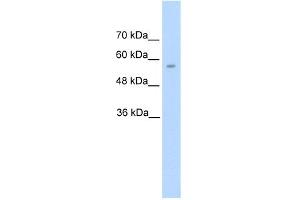 WB Suggested Anti-DDC Antibody Titration:  5. (DDC antibody  (N-Term))
