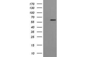 Western Blotting (WB) image for anti-Formiminotransferase Cyclodeaminase (FTCD) antibody (ABIN2715577) (FTCD antibody)