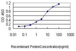 Detection limit for recombinant GST tagged PSPH is approximately 0.