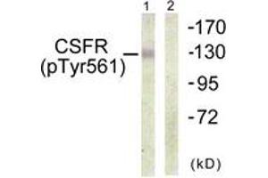 Western blot analysis of extracts from HepG2 cells, using CSFR (Phospho-Tyr561) Antibody.