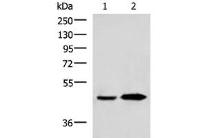 Western blot analysis of Human fetal liver tissue and Human liver tissue lysates using BHMT2 Polyclonal Antibody at dilution of 1:800 (BHMT2 antibody)