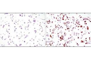 Immunocytochemistry analysis of HCC827 cells, untransfected (left) or transfected with GFP (right) using GFP antibody . (GFP antibody)