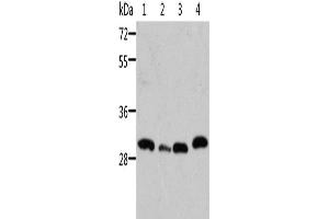 Western Blotting (WB) image for anti-STE20-Related Kinase Adaptor beta (STRADB) antibody (ABIN2429143) (STRADB antibody)
