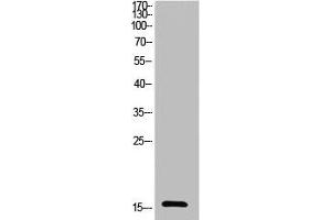 Western Blot analysis of HeLa cells using Acetyl-Ub (K27) Polyclonal Antibody (UBA52/RPS27A/UBB/UBC (acLys27) antibody)