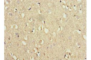 Immunohistochemistry of paraffin-embedded human brain tissue using ABIN7175774 at dilution of 1:100 (WDR6 antibody  (AA 1-200))