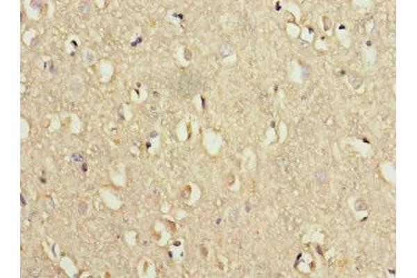WDR6 antibody  (AA 1-200)
