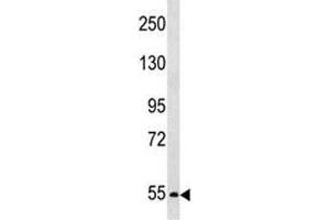 PCSK4 antibody western blot analysis in SK-BR-3 lysate. (PCSK4 antibody  (AA 168-196))