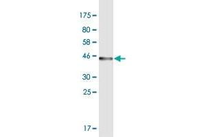 Western Blot detection against Immunogen (43. (ODAM antibody  (AA 1-153))