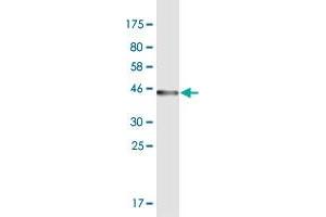 Western Blot detection against Immunogen (43. (ODAM antibody  (AA 1-153))