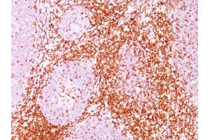 Formalin-fixed, paraffin-embedded human Tonsil stained with CD6 Mouse Monoclonal Antibody (C6/372).