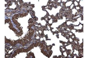IHC-P Image CLIC3 antibody [N1C3] detects CLIC3 protein at membrane and cytoplasm on mouse lung by immunohistochemical analysis. (CLIC3 antibody)