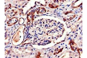 Immunohistochemistry of paraffin-embedded human kidney tissue using ABIN7144520 at dilution of 1:100 (AQP6 antibody  (AA 1-30))