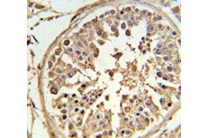 Immunohistochemistry (IHC) image for anti-ATP-Binding Cassette, Sub-Family F (GCN20), Member 1 (ABCF1) (AA 687-716) antibody (ABIN5647444)