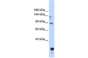 WB Suggested Anti-TULP4 Antibody Titration:  0. (TULP4 antibody  (N-Term))