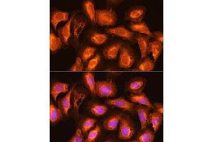 Immunofluorescence analysis of U2OS cells using SEC11A Rabbit pAb (ABIN6133117, ABIN6147478, ABIN6147479 and ABIN6214843) at dilution of 1:100. (SEC11A antibody  (AA 37-145))