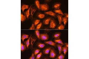 Immunofluorescence analysis of U2OS cells using SEC11A Rabbit pAb (ABIN6133117, ABIN6147478, ABIN6147479 and ABIN6214843) at dilution of 1:100.