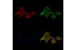ABIN7093101 and ABIN7097255 staining Hela cells(heat shock treatment) by IF/ICC. (MLKL antibody  (pThr349))
