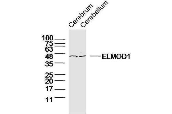 ELMOD1 anticorps  (AA 21-120)