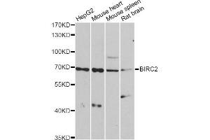 Western blot analysis of extracts of various cell lines, using BIRC2 antibody (ABIN6292780) at 1:1000 dilution. (BIRC2 antibody)