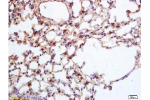 Formalin-fixed and paraffin embedded mouse lung labeled with Rabbit Anti CXC-R2 Polyclonal Antibody, Unconjugated (ABIN1386761) at 1:200 followed by conjugation to the secondary antibody and DAB staining (CXCR2 antibody)