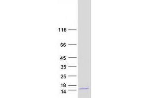 Validation with Western Blot (MANBAL Protein (Transcript Variant 1) (Myc-DYKDDDDK Tag))