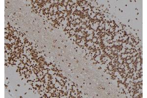 ABIN6277385 at 1/100 staining Rat brain tissue by IHC-P. (HOXC8 antibody  (Internal Region))