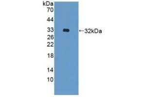 Western blot analysis of recombinant Human ADAM33. (ADAM33 antibody  (AA 210-503))