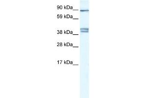 WB Suggested Anti-CLCNKB Antibody Titration:  0. (CLCNKB antibody  (C-Term))