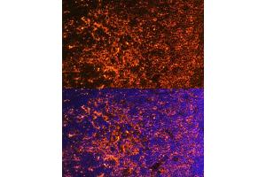 Immunofluorescence analysis of mouse thymus using ICOS/CD278 antibody (ABIN3022590, ABIN3022591, ABIN3022592, ABIN1513055 and ABIN6218929) at dilution of 1:100. (ICOS antibody  (AA 21-140))