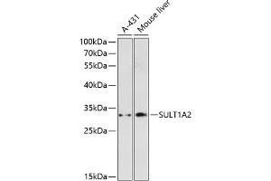 Western blot analysis of extracts of various cell lines, using SULT1 antibody (ABIN6132917, ABIN6148705, ABIN6148706 and ABIN6216631) at 1:3000 dilution. (SULT1A2 antibody  (AA 201-295))