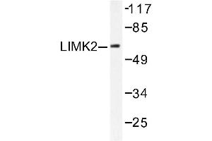 Image no. 1 for anti-LIM Domain Kinase 2 (LIMK2) antibody (ABIN265509)