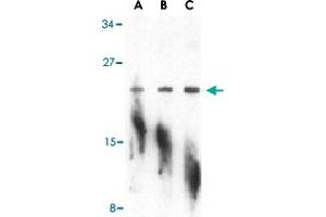 Western blot analysis of PTRH2 in A-20 cell lysate with PTRH2 polyclonal antibody  at (A) 1, (B) 2, and (C) 4 ug/mL . (PTRH2 antibody  (N-Term))