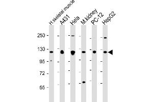 All lanes : Anti-Vinculin at 1:2000 dilution Lane 1: human skeletal muscle lysate Lane 2: A431 whole cell lysate Lane 3: Hela whole cell lysate Lane 4: mouse kidney lysate Lane 5: PC-12 whole cell lysate Lane 6: HepG2 whole cell lysate Lysates/proteins at 20 μg per lane. (Vinculin antibody  (AA 903-937))