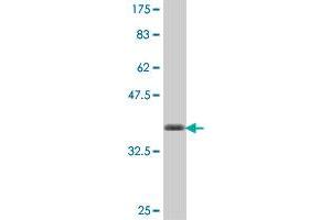 Western Blot detection against Immunogen (36. (PDE6C antibody  (AA 3-100))